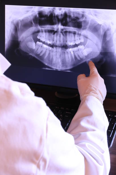 Best Emergency Dental Care for Broken or Chipped Teeth in Wilsonville, AL
